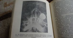 Продается учебная литература: Н. Н. Бажанов. Стоматология.1978. Медицина