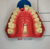 Эстетико-функциональные принципы моделирования зубов. Жевательная группа