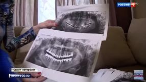 Про удаление 22 зубов: только факты глазами стоматолога и юриста