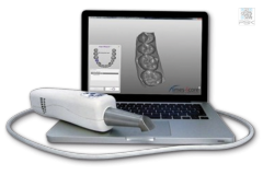Интраоральный сканер MHT 3D PROGRESS