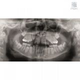 Ортопантомограф KaVo Pan eXam Plus 2D